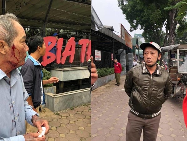 Hà Nội: Cảnh sát vào cuộc vụ gã xe ôm đánh cụ ông 80 tuổi nhập viện