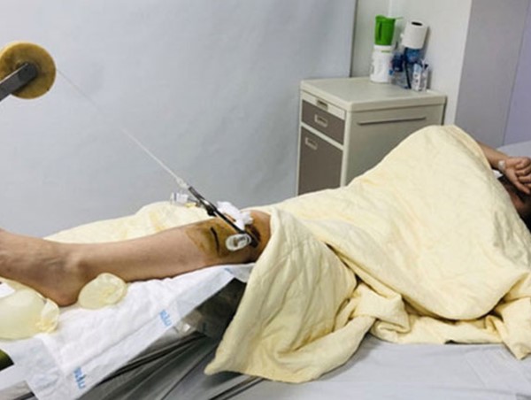 Truy tìm siêu xe gây tai nạn bỏ chạy