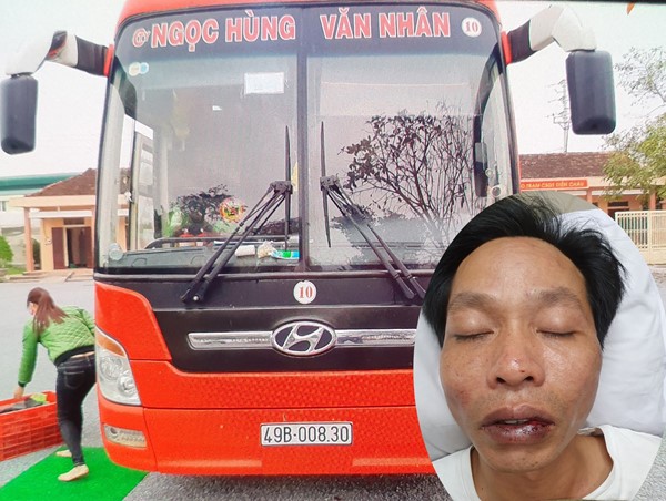 Bị lôi lên xe khách đánh đến nhập viện vì... không cho đỗ trước cửa hàng?