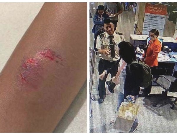 Nữ hành khách cắn nhân viên hàng không trong khi tranh cãi về hành lý quá cân