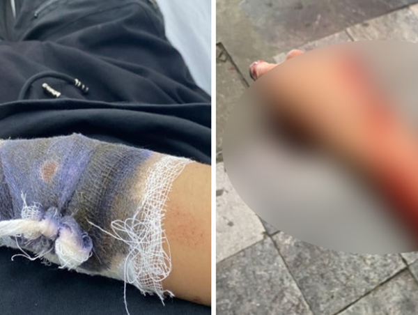 Truy tìm nhóm thanh niên dùng hung khí cướp xe máy tại Hà Nội