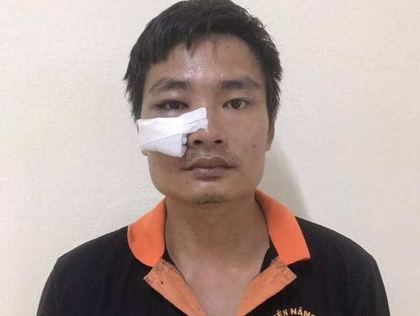 Bắt khẩn cấp người đàn ông tông gãy chân Cảnh sát giao thông