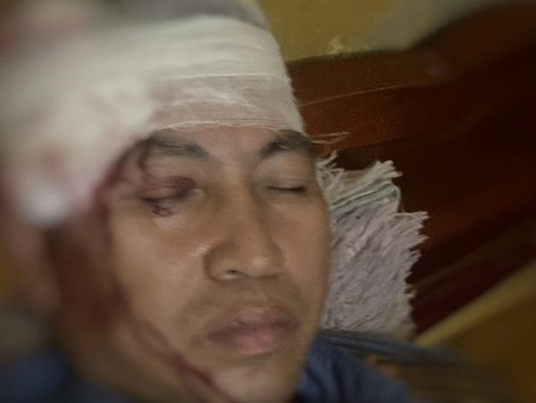 Xác định 8 đối tượng ném đá trọng thương phụ lái tàu tuyến Hà Nội - Lào Cai