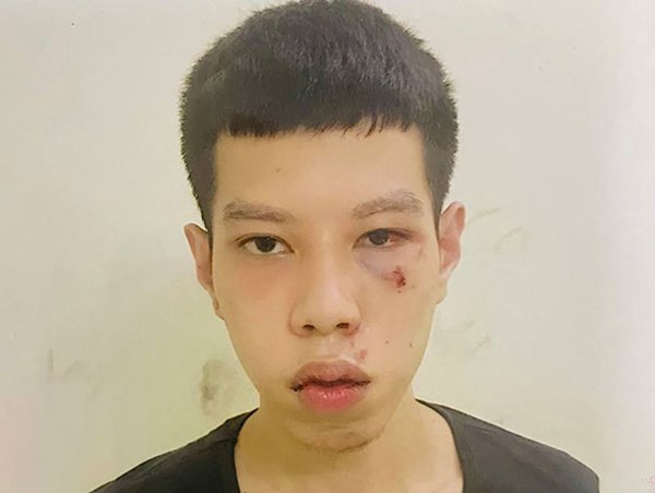 Bắt đối tượng cướp tiền lương hưu của cụ bà 70 tuổi