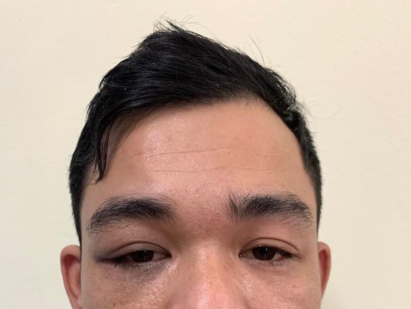 Bắt kẻ đánh thuốc ngủ bạn gái, cướp tài sản tại thị xã Sơn Tây