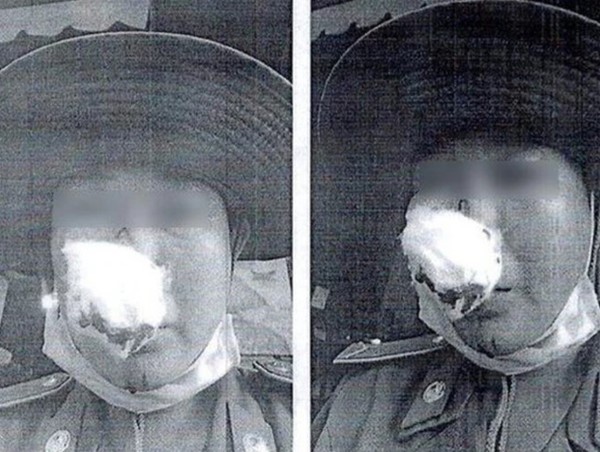 Phạt 6,5 triệu đồng người đàn ông hành hung nữ nhân viên thu phí đậu xe