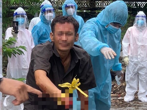 Ném đá vào xe chở FO, người đàn ông bị chém lìa bàn tay