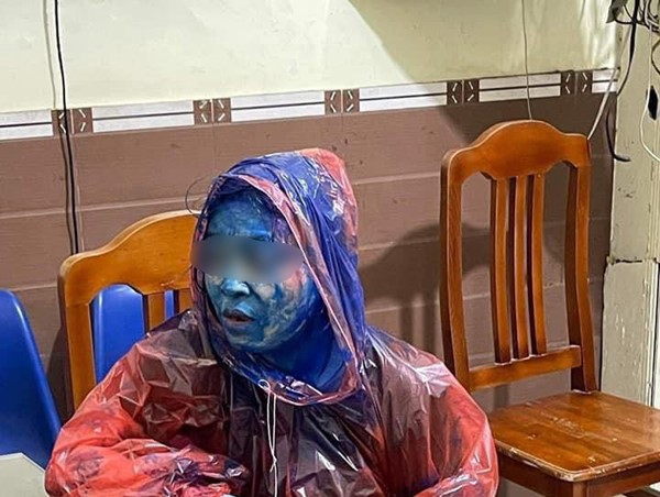 Hải Phòng: Người phụ nữ bị kẻ lạ mặt tạt sơn kín người lúc rạng sáng