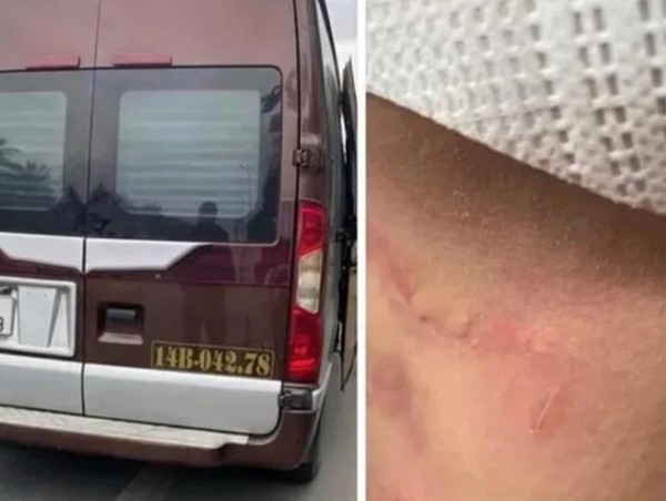 Quảng Ninh: Công an vào cuộc xác minh vụ hành khách tố bị nhà xe hành hung