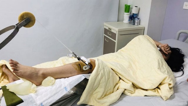 Truy tìm siêu xe gây tai nạn bỏ chạy