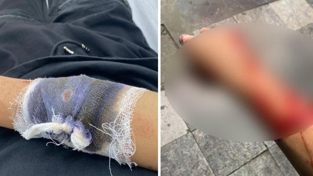 Truy tìm nhóm thanh niên dùng hung khí cướp xe máy tại Hà Nội