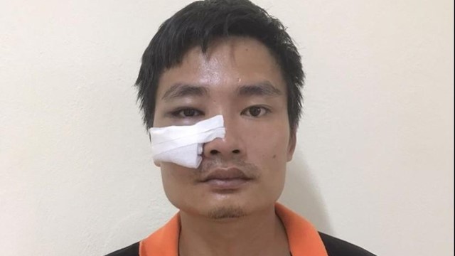 Bắt khẩn cấp người đàn ông tông gãy chân Cảnh sát giao thông