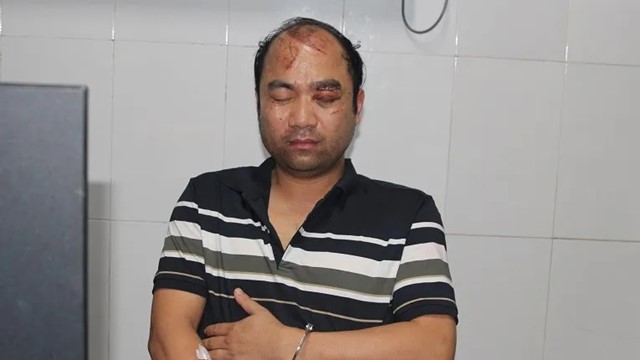 Nghệ An: tạm giữ hình sự tài xế ô tô gây tai nạn khiến 3 người tử vong