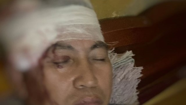 Xác định 8 đối tượng ném đá trọng thương phụ lái tàu tuyến Hà Nội - Lào Cai