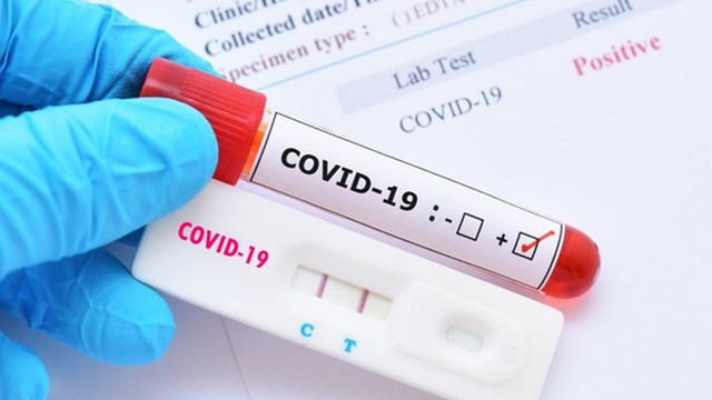 Thủ tướng yêu cầu Bộ Y tế thông tin chính thức việc có hay không kit xét nghiệm phát hiện Omicron