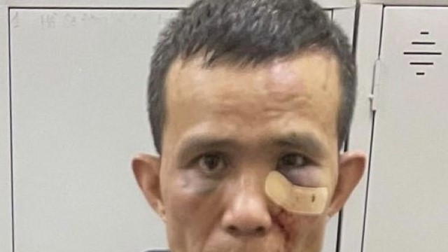 Người dân bắt giữ tên trộm có 6 tiền án bàn giao cho CQCA